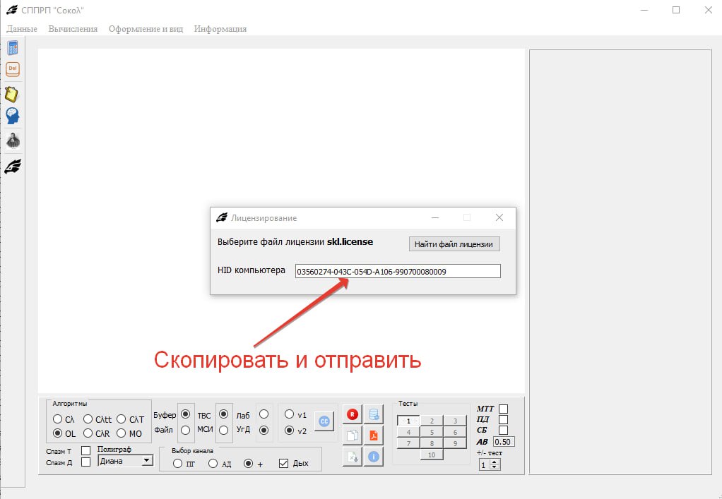 Окно лицензирования